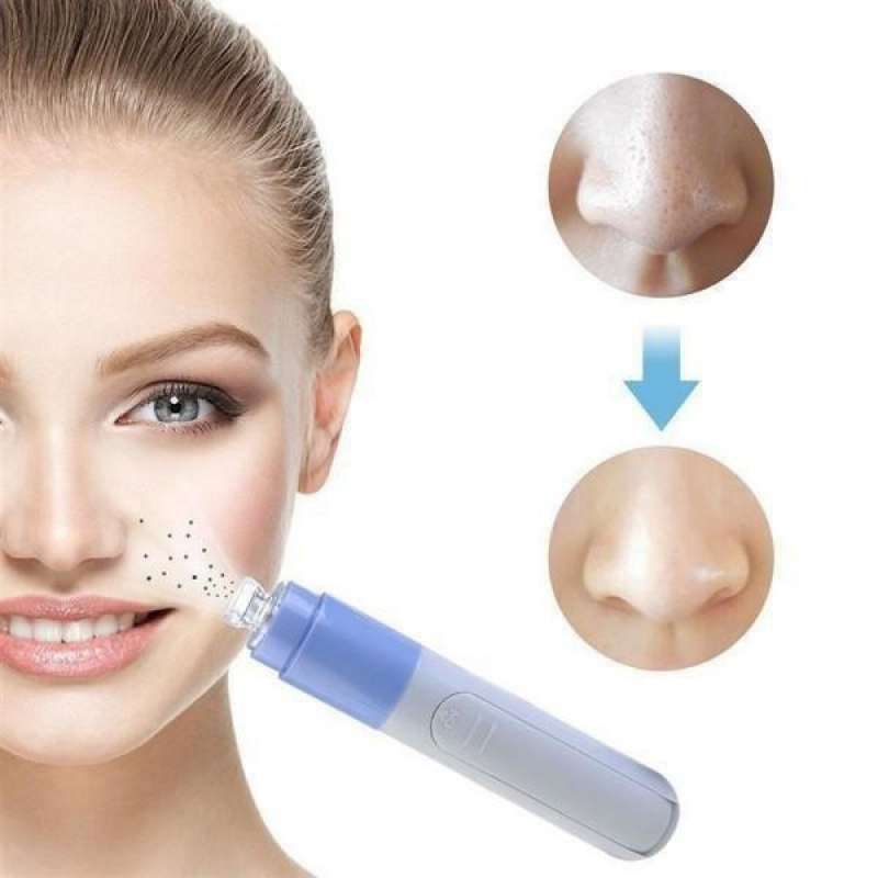 Aspirador facial púrpura para puntos negros - extractor de puntos negros a precios de mayorista